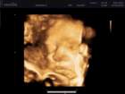 _vincent_10005_small.jpg