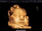 _vincent_10006_small.jpg