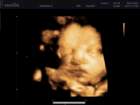 _vincent_10007_small.jpg